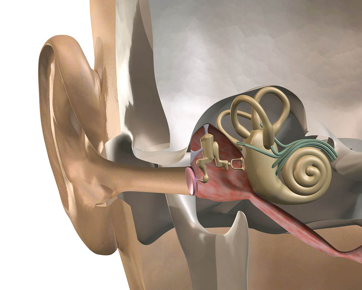 Dióhéjban az idegi halláskárosodásról